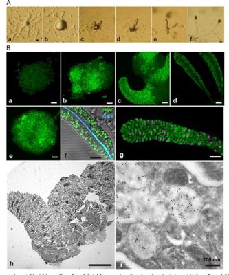  Acytostelium! A Tiny Amoeba That Shows Us the Power of Cooperation