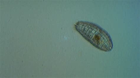  Coleps! This Tiny Ciliate Is Living Proof That Size Doesn't Matter When It Comes to Thriving in Diverse Aquatic Environments