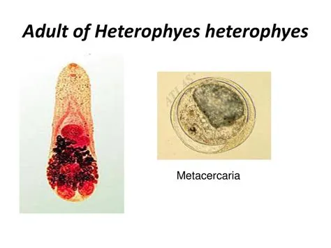  Heterophyes! A Tiny Trematode With Big Appetite and Even Bigger Travel Plans