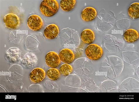  Peridinium – Näkevät mikrokosmosissa ja ravintoketjujen kulmakiviä!